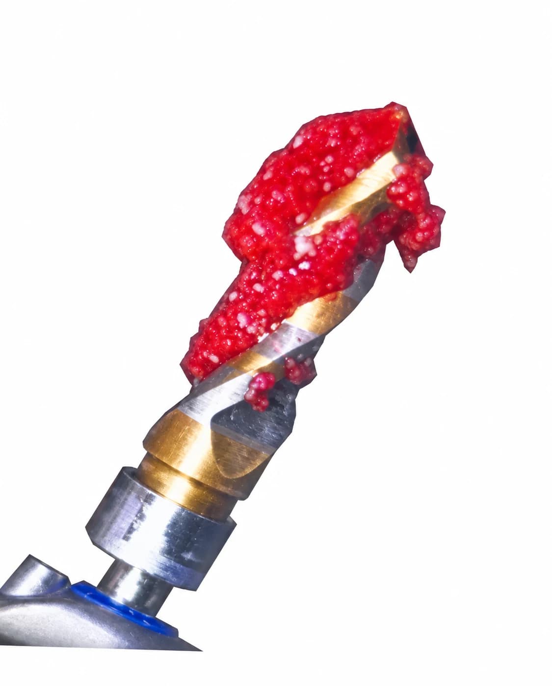 Autogenous bone chips collected on the flutes of a large-diameter Crown Down tungsten carbide implant drill during dry, low-speed osteotomy preparation, ready for immediate placement into the same surgical site.