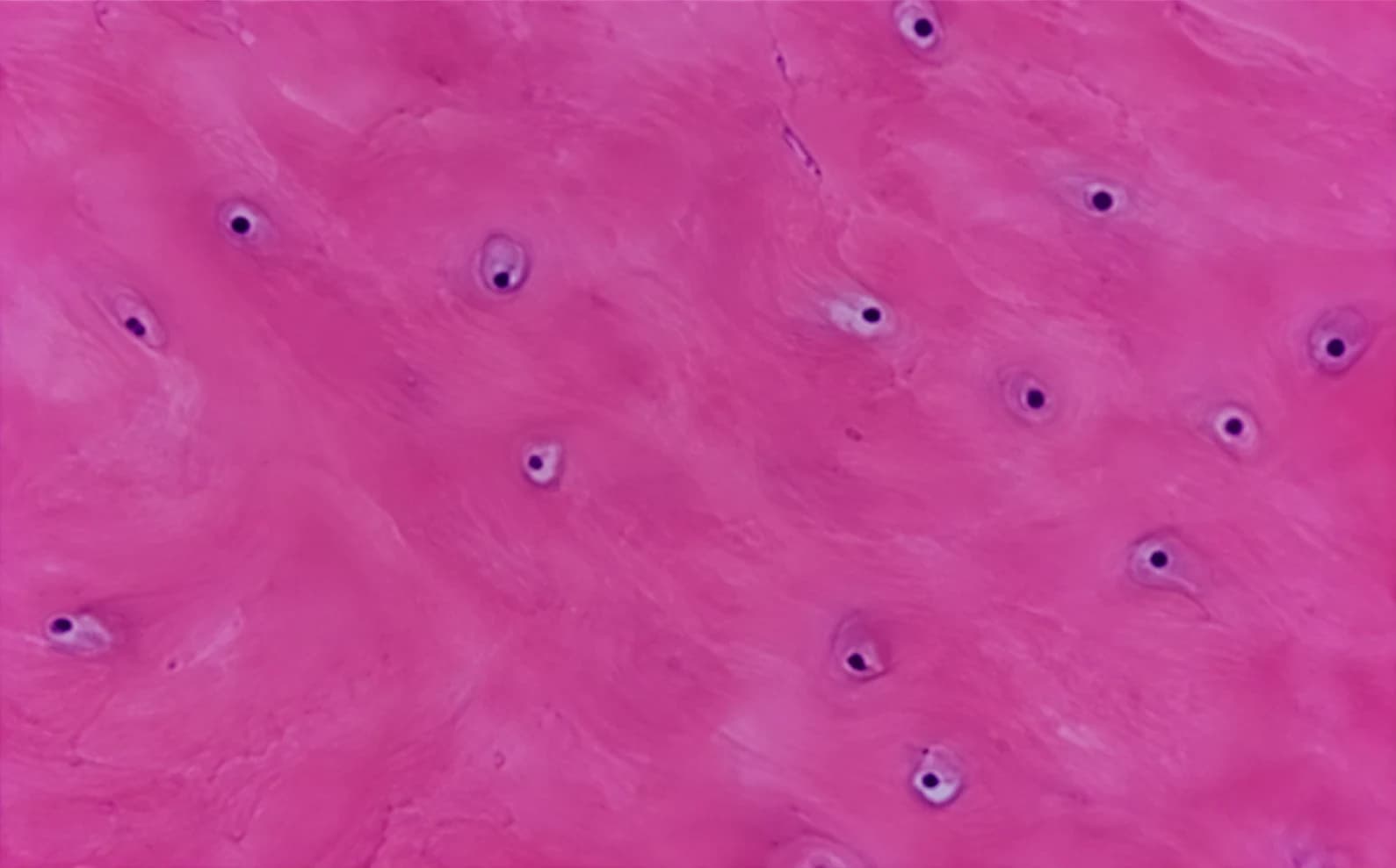 Illustrative histology of healthy bone: organized matrix with visible osteocytes and intact nuclei inside their lacunae.