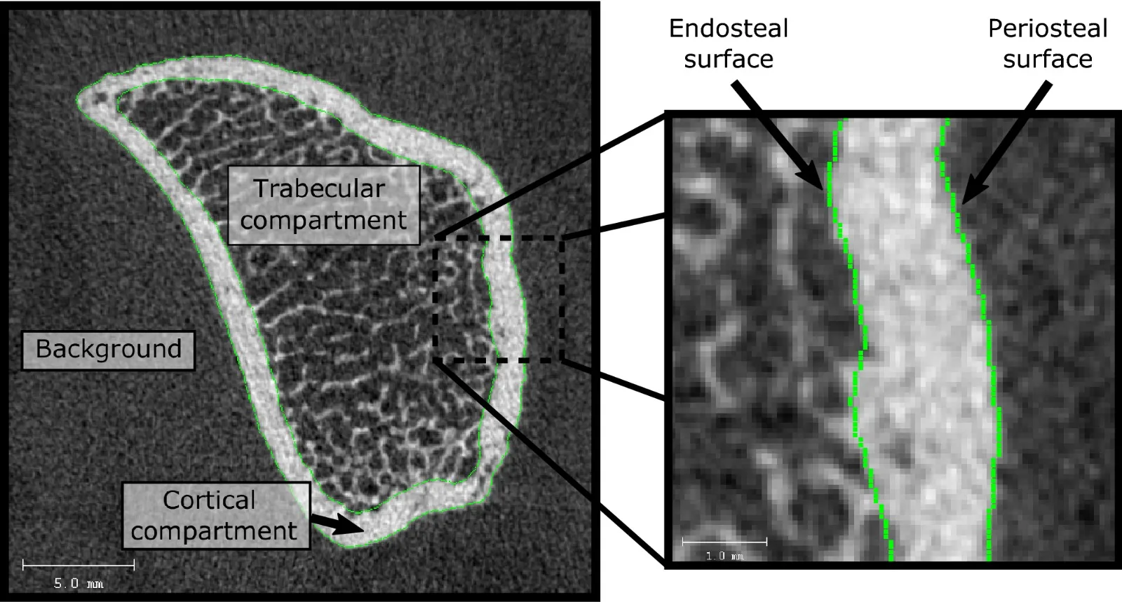 Micro-CT scan of dental bone showing the cortical compartment (dense outer shell), trabecular compartment (porous interior), and the endosteal and periosteal surfaces of the cortical layer labeled at high magnification.