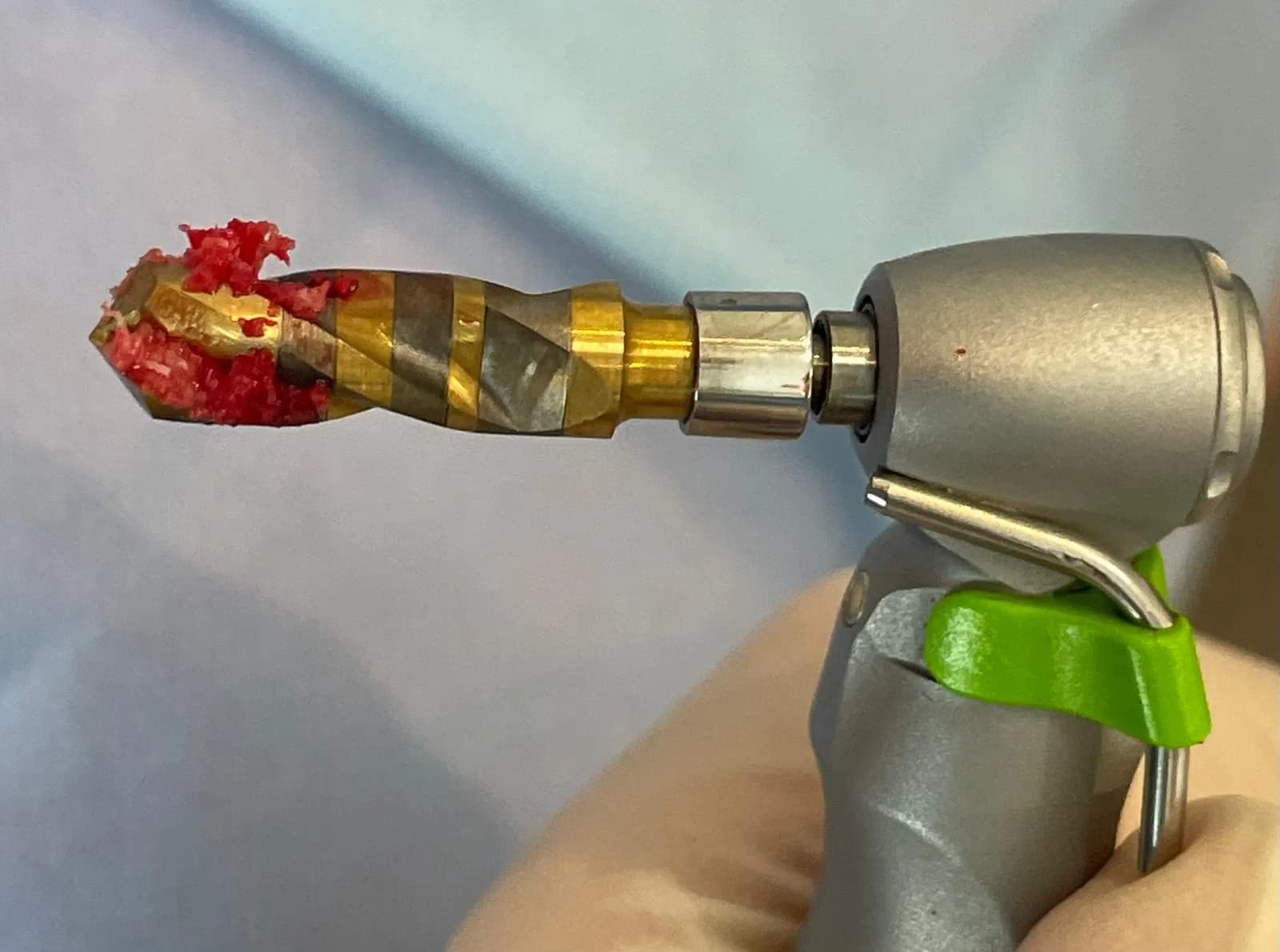 Macro view of the Crown Down carbide drill retracted from the osteotomy with a visible mass of autogenous bone particles held on the drill flutes