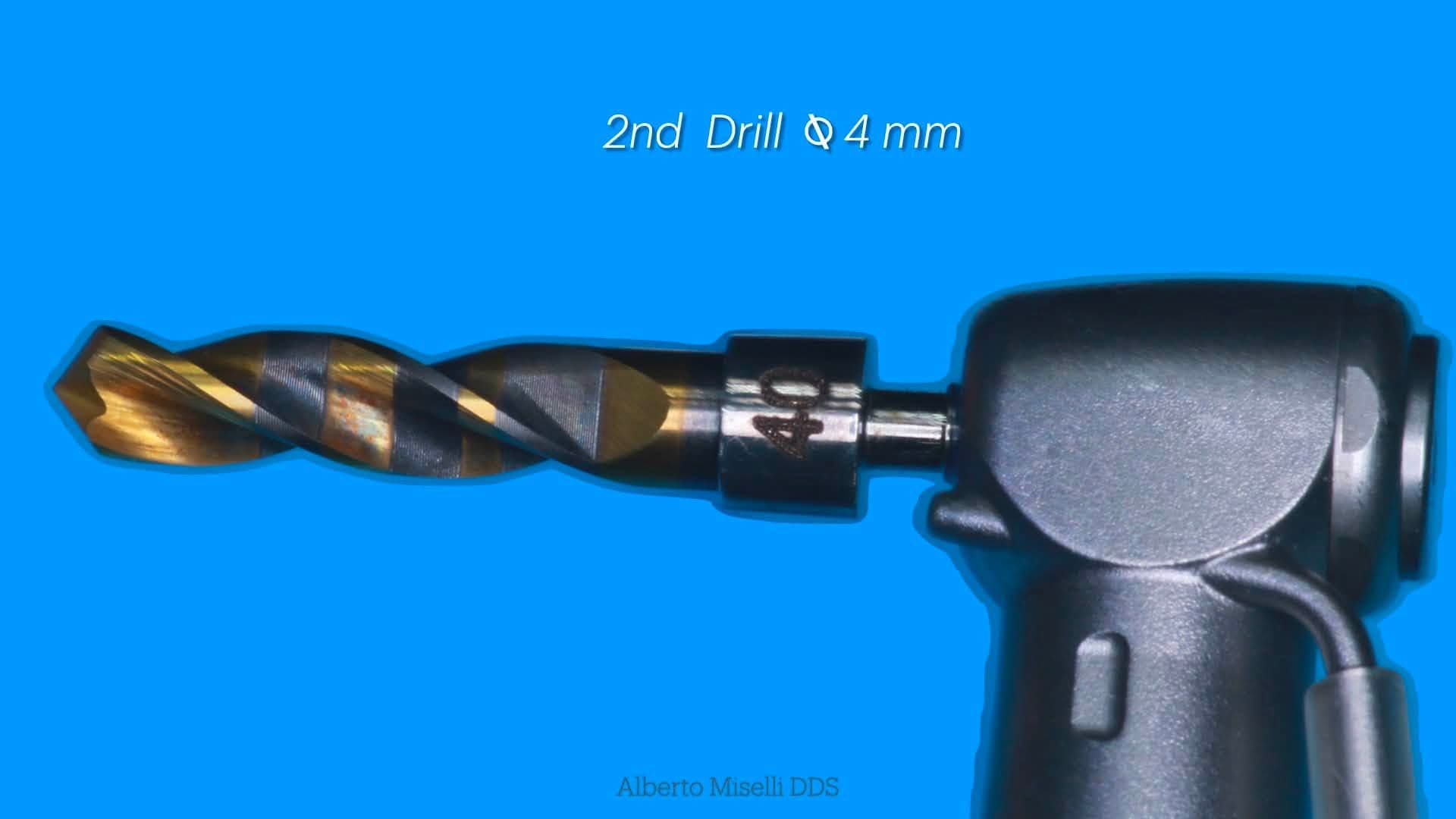 Second drill in the Crown Down sequence, Ø 4 mm tungsten carbide, mounted on the surgical handpiece