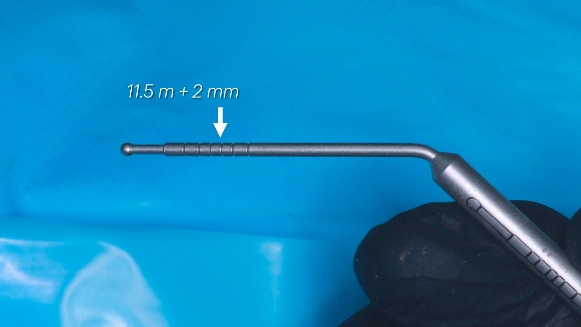 Graduated depth probe reading 11.5 mm + 2 mm reference for the planned implant length
