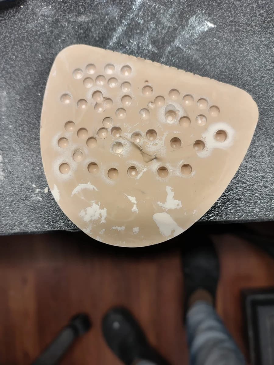 In-vitro test of a stainless steel dental implant drill on dental stone after twenty 3 mm-deep osteotomies, showing the cutting edge worn into a wide flat surface instead of a sharp edge.